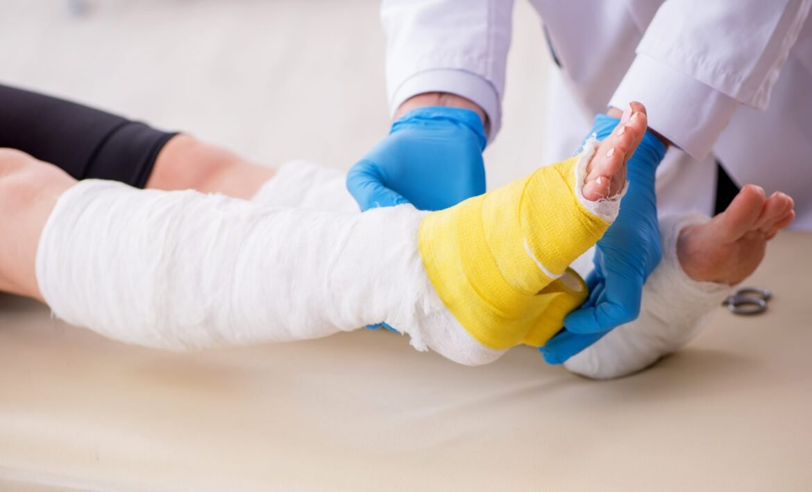 Burn Injury Lawyer in San Jose, CA
