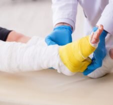 Burn Injury Lawyer in San Jose, CA