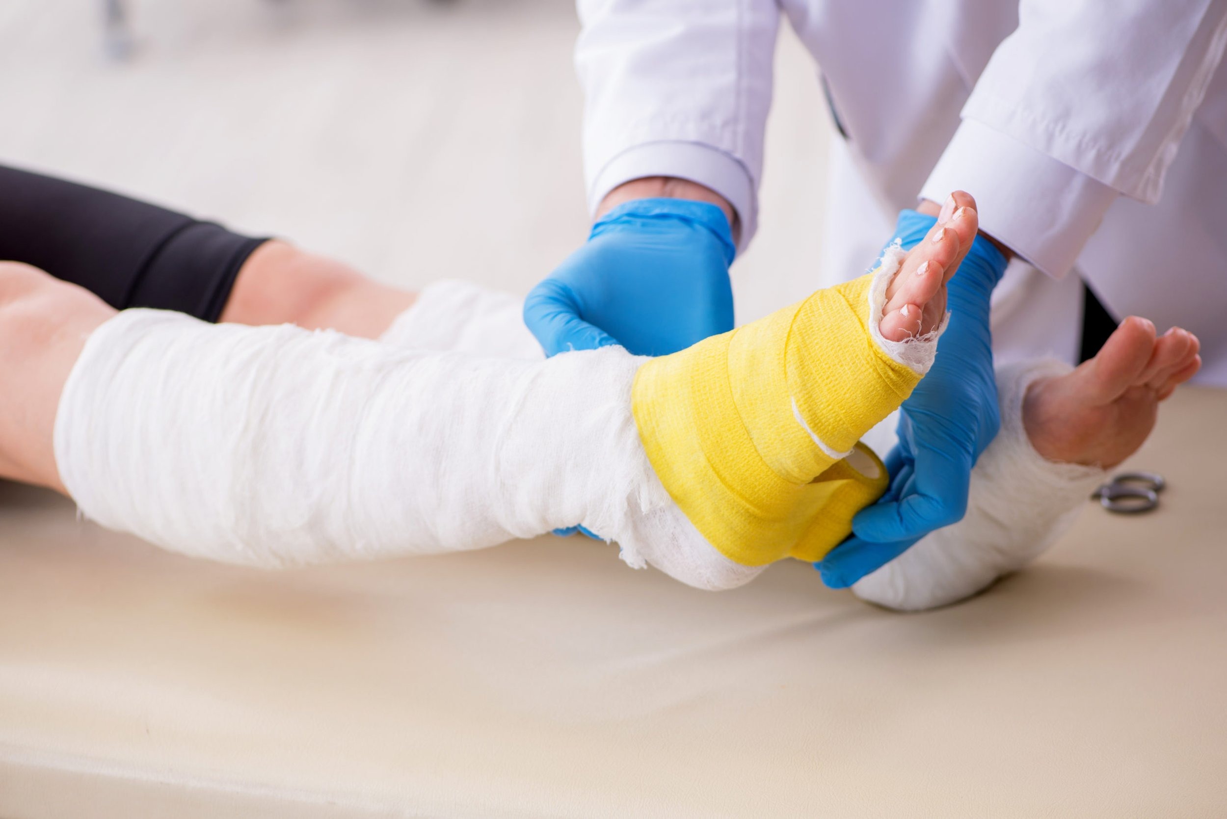 Burn Injury Lawyer in San Jose, CA